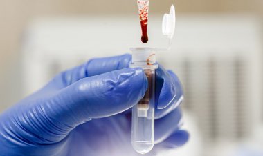 Lab-grown blood given to humans in world-first trial aimed at combatting rare disorders